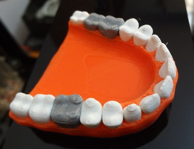 Teeth with a silver teeth prothesis 3D Print 120143