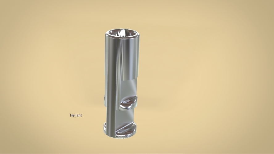 Digital Anatomical Screw Retained Abutment 3D Print 127116 Digital Anatomical Screw Retained Abutment 3D Print 127116