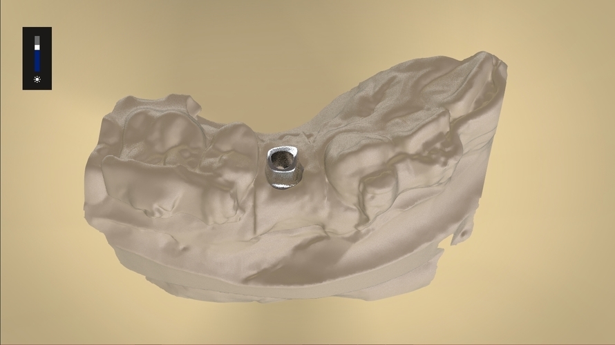 Digital Anatomical Screw Retained Abutment 3D Print 127119 Digital Anatomical Screw Retained Abutment 3D Print 127119