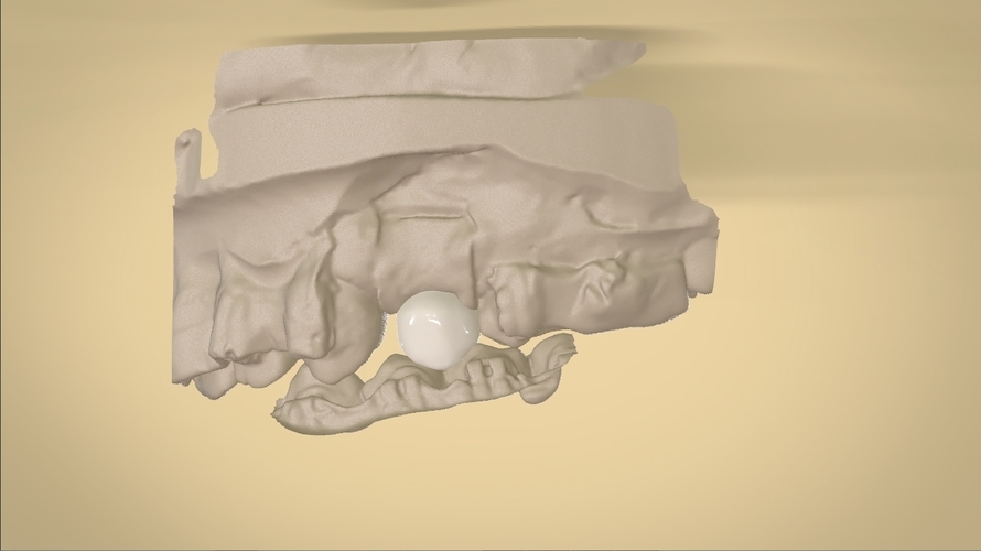 Digital Anatomical Screw Retained Abutment 3D Print 127122 Digital Anatomical Screw Retained Abutment 3D Print 127122