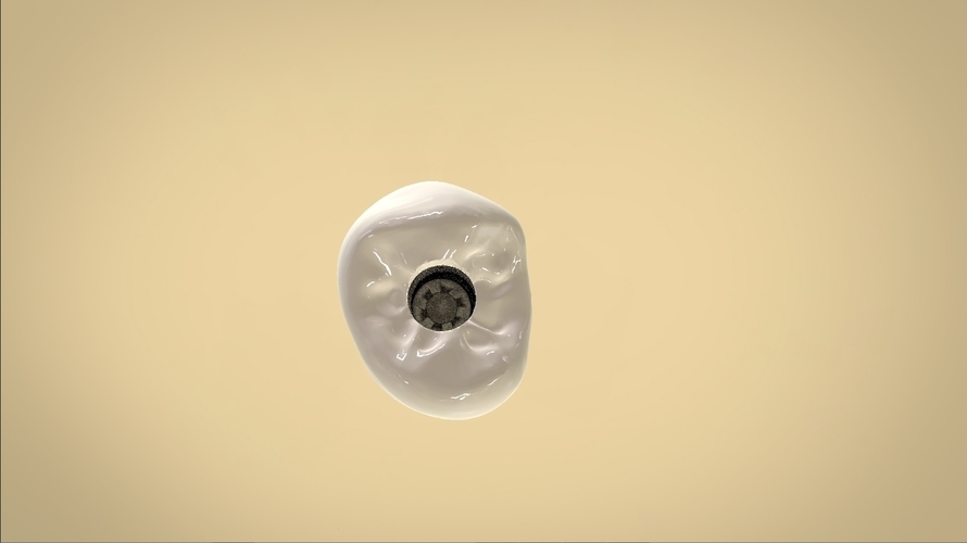 Digital Anatomical Screw Retained Abutment 3D Print 127125 Digital Anatomical Screw Retained Abutment 3D Print 127125