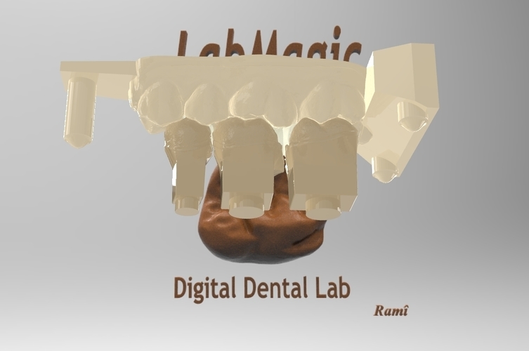 Digital Dental Inlay Bridge Model for 3D Printing 3D Print 128448 Digital Dental Inlay Bridge Model for 3D Printing 3D Print 128448