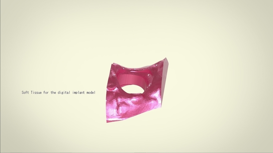 Digital Dental Implant Model with Positioning Guide 3D Print 128767 Digital Dental Implant Model with Positioning Guide 3D Print 128767