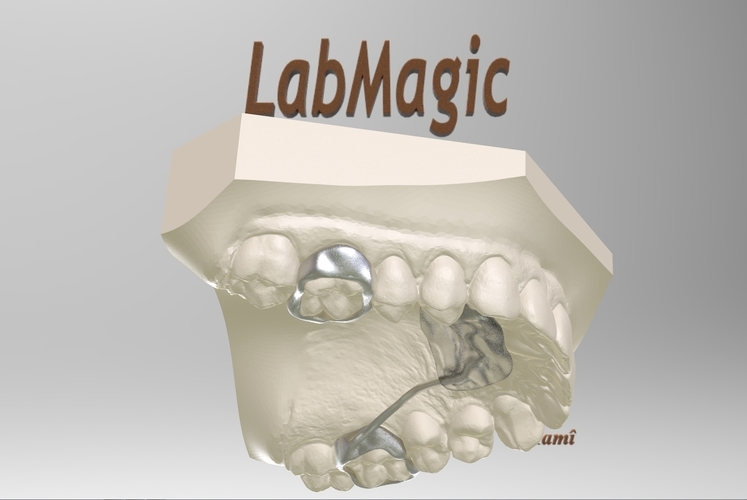 Digital Nance Holder Appliance 3D Print 131803 Digital Nance Holder Appliance 3D Print 131803