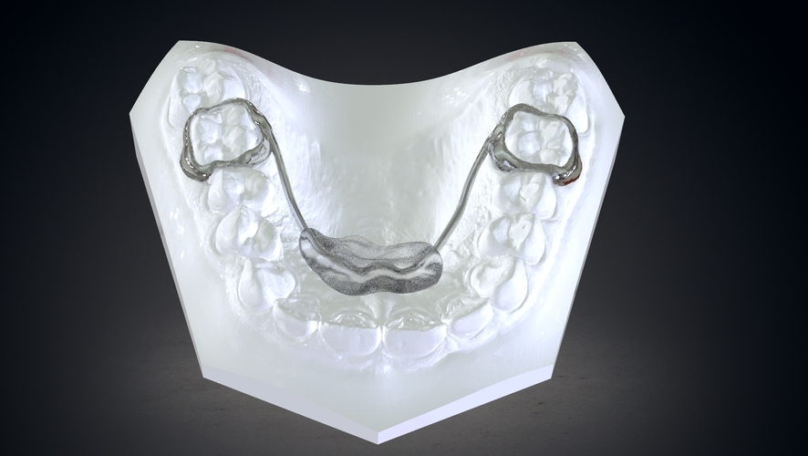 Digital Nance Holder Appliance 3D Print 131804 Digital Nance Holder Appliance 3D Print 131804