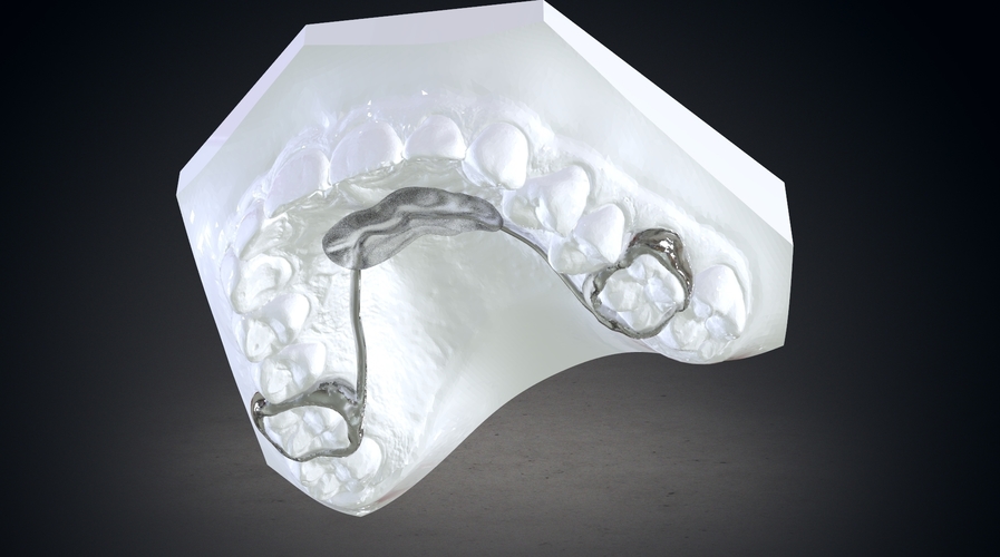 Digital Nance Holder Appliance 3D Print 131805 Digital Nance Holder Appliance 3D Print 131805