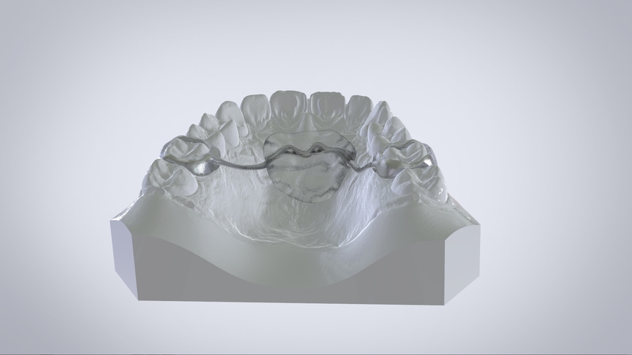 Digital Nance Holder Appliance 3D Print 131808 Digital Nance Holder Appliance 3D Print 131808