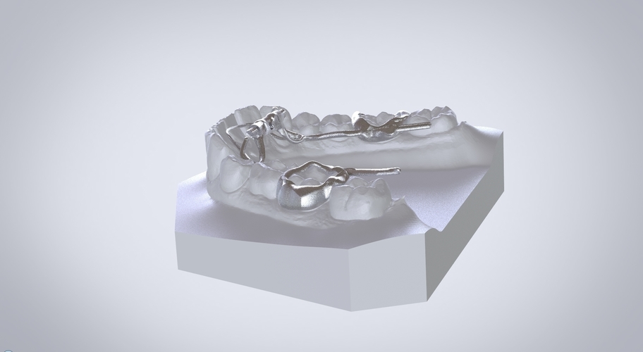 Digital Dr.Williams's Ortho Appliance 3D Print 132589 Digital Dr.Williams's Ortho Appliance 3D Print 132589
