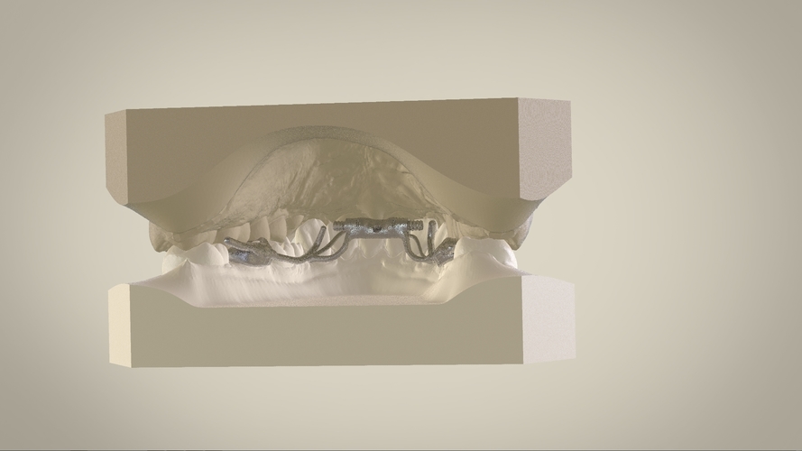 Digital Dr.Williams's Ortho Appliance 3D Print 132597 Digital Dr.Williams's Ortho Appliance 3D Print 132597