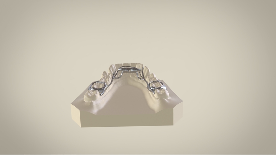 Digital Dr.Williams's Ortho Appliance 3D Print 132598 Digital Dr.Williams's Ortho Appliance 3D Print 132598