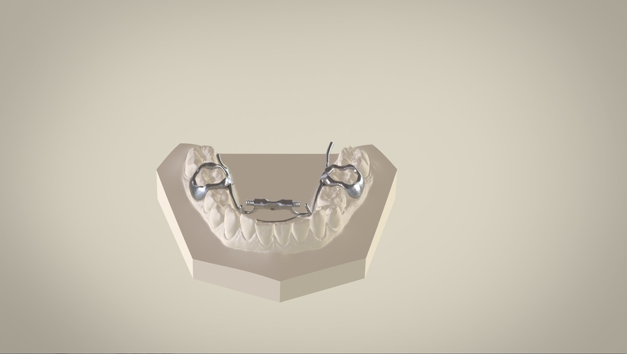 Digital Dr.Williams's Ortho Appliance 3D Print 132600 Digital Dr.Williams's Ortho Appliance 3D Print 132600