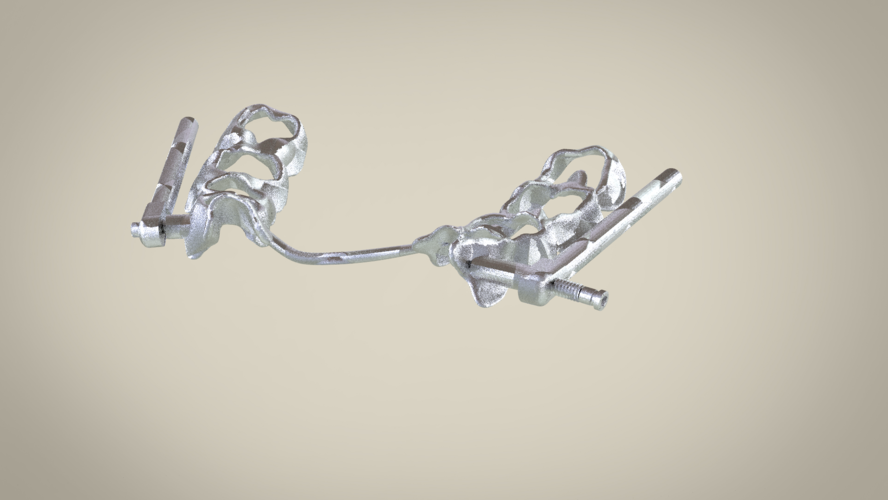 Herbst Cast Splint (Orthodontics) 3D Print 147535 Herbst Cast Splint (Orthodontics) 3D Print 147535