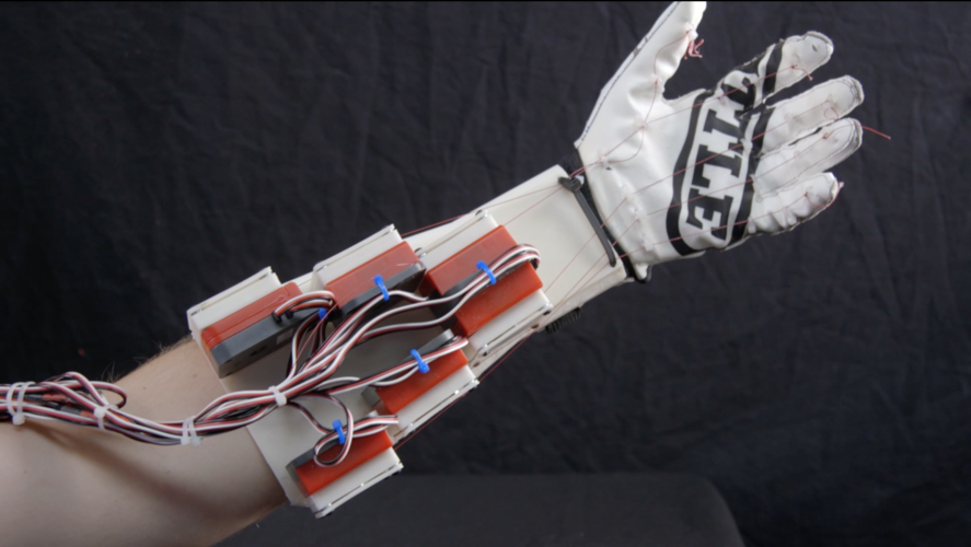 Biomimetic Robotic Prosthetic Hand 3D Print 149839