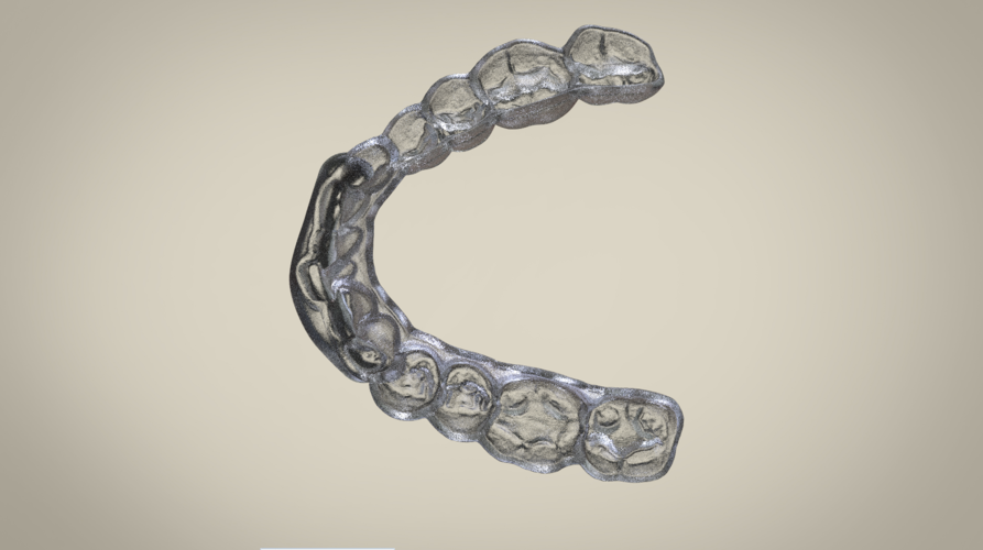 Digital Ortho Superior Repositioner Splint 3D Print 154815 Digital Ortho Superior Repositioner Splint 3D Print 154815