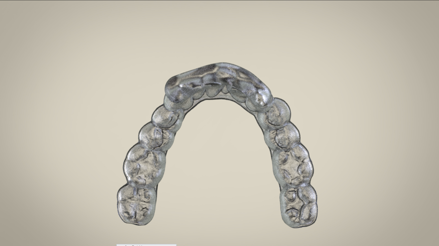 Digital Ortho Superior Repositioner Splint 3D Print 154816 Digital Ortho Superior Repositioner Splint 3D Print 154816