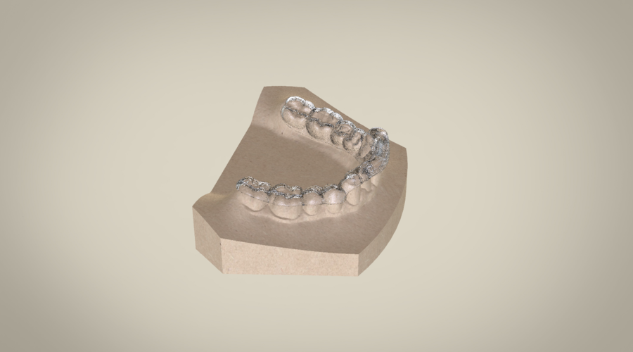Digital Ortho Superior Repositioner Splint 3D Print 154817 Digital Ortho Superior Repositioner Splint 3D Print 154817