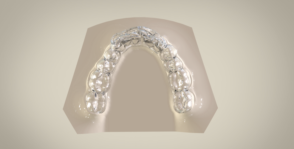 Digital Ortho Superior Repositioner Splint 3D Print 154818 Digital Ortho Superior Repositioner Splint 3D Print 154818
