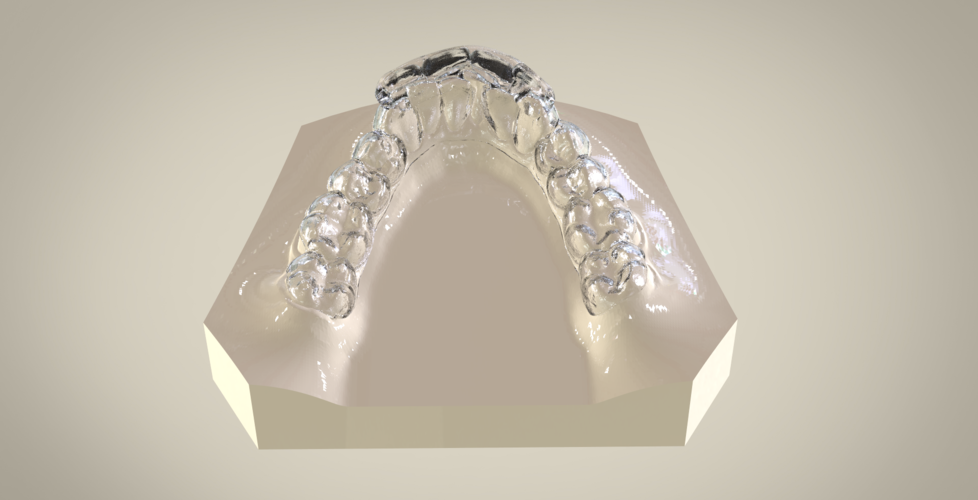 Digital Ortho Superior Repositioner Splint 3D Print 154819 Digital Ortho Superior Repositioner Splint 3D Print 154819