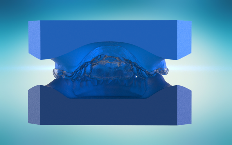 Digital Ortho Anterior Repositioner Splint 3D Print 155214 Digital Ortho Anterior Repositioner Splint 3D Print 155214