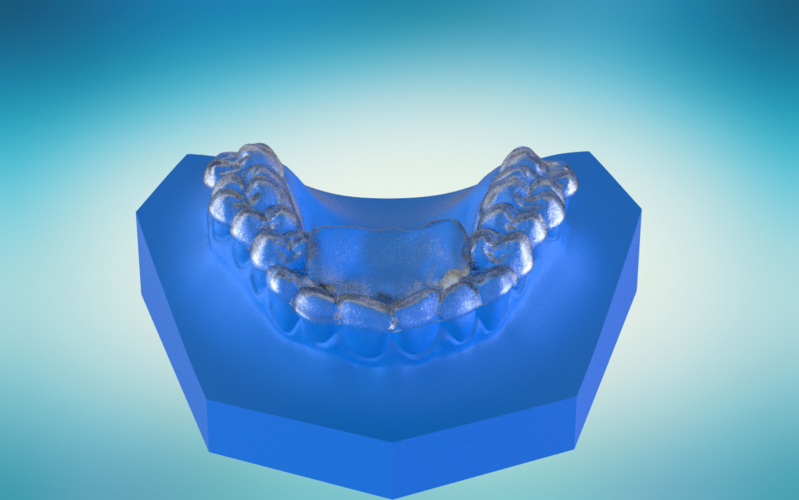Digital Ortho Anterior Repositioner Splint 3D Print 155215 Digital Ortho Anterior Repositioner Splint 3D Print 155215