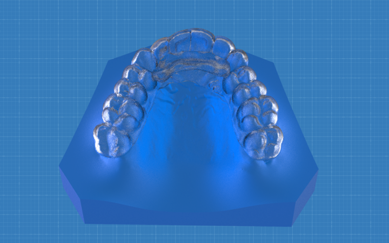 Digital Ortho Anterior Repositioner Splint 3D Print 155216 Digital Ortho Anterior Repositioner Splint 3D Print 155216
