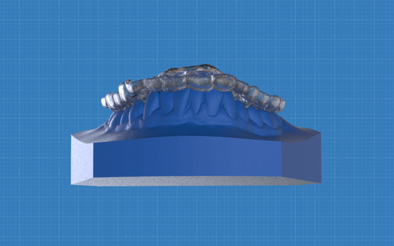 Digital Ortho Anterior Repositioner Splint 3D Print 155217 Digital Ortho Anterior Repositioner Splint 3D Print 155217
