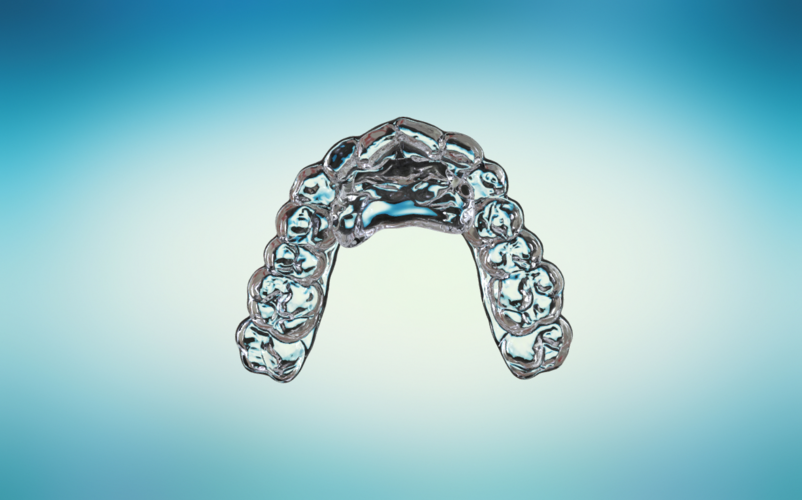 Digital Ortho Anterior Repositioner Splint 3D Print 155218 Digital Ortho Anterior Repositioner Splint 3D Print 155218