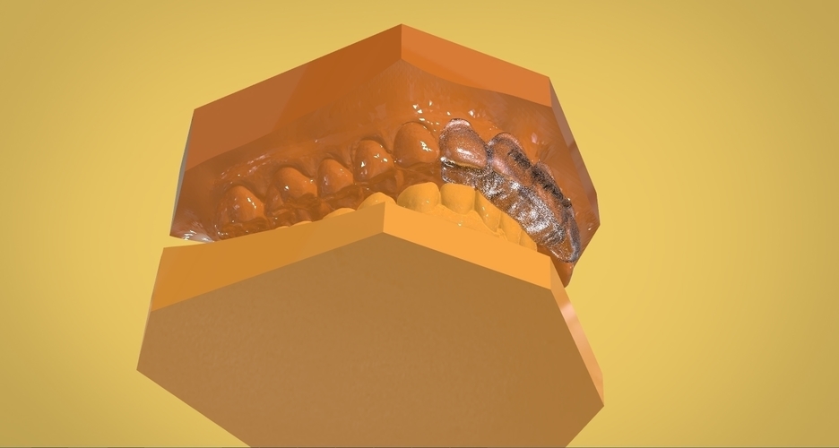 Digital Anti Migraine Appliance 3D Print 157188 Digital Anti Migraine Appliance 3D Print 157188