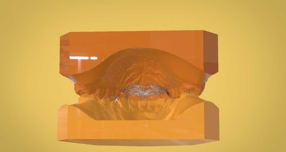 Digital Anti Migraine Appliance 3D Print 157190 Digital Anti Migraine Appliance 3D Print 157190