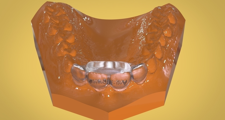 Digital Anti Migraine Appliance 3D Print 157191 Digital Anti Migraine Appliance 3D Print 157191