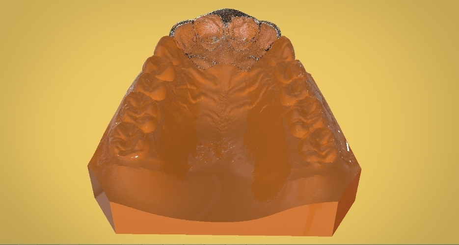 Digital Anti Migraine Appliance 3D Print 157192 Digital Anti Migraine Appliance 3D Print 157192