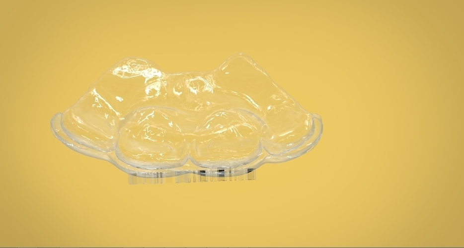 Digital Anti Migraine Appliance 3D Print 157194 Digital Anti Migraine Appliance 3D Print 157194