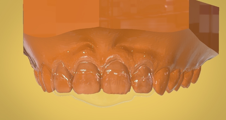 Digital Anti Migraine Appliance 3D Print 157195 Digital Anti Migraine Appliance 3D Print 157195