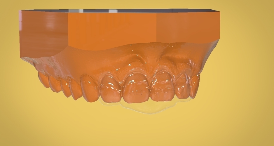 Digital Anti Migraine Appliance 3D Print 157197 Digital Anti Migraine Appliance 3D Print 157197