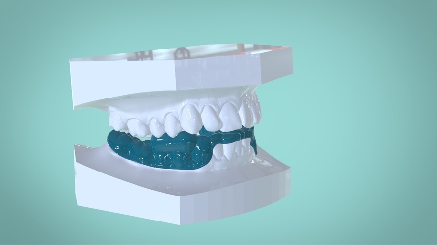 Digital Morning Repositioning Deprogrammer 3D Print 158719 Digital Morning Repositioning Deprogrammer 3D Print 158719