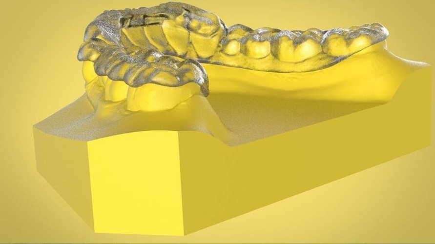 Digital OrthoTanner Repositioner 3D Print 158752 Digital OrthoTanner Repositioner 3D Print 158752