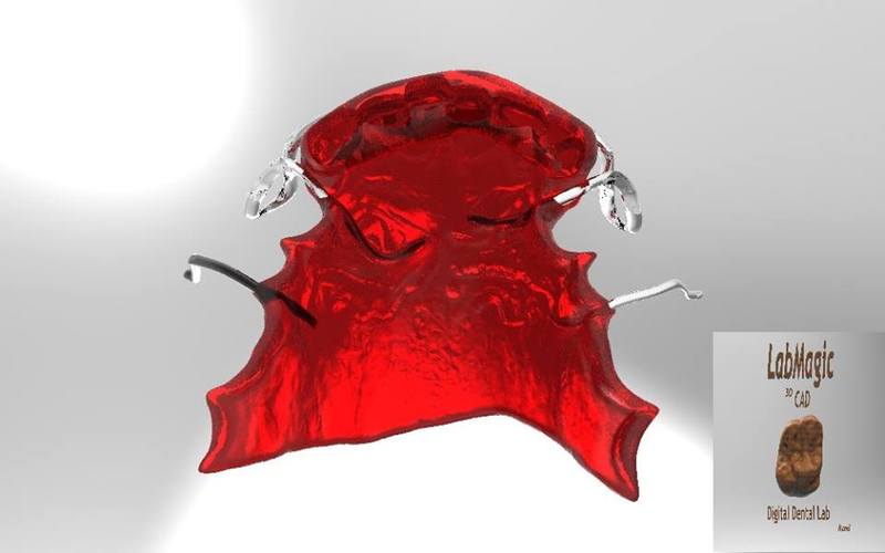 Digital Activator Splint (Orthodontic Appliance) 3D Print 15896 Digital Activator Splint (Orthodontic Appliance) 3D Print 15896