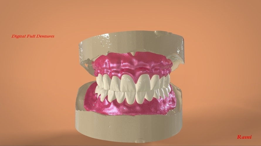 Digital Full Dentures 3D Print 159105 Digital Full Dentures 3D Print 159105