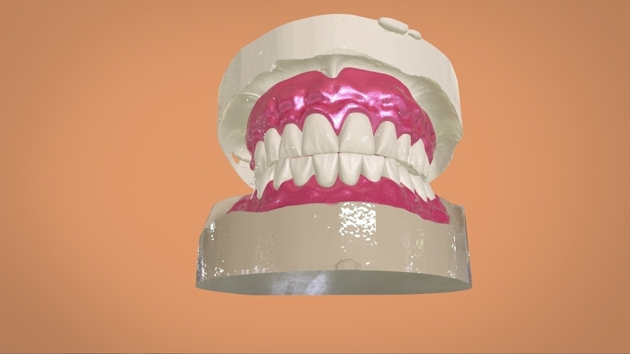 Digital Full Dentures 3D Print 159109 Digital Full Dentures 3D Print 159109