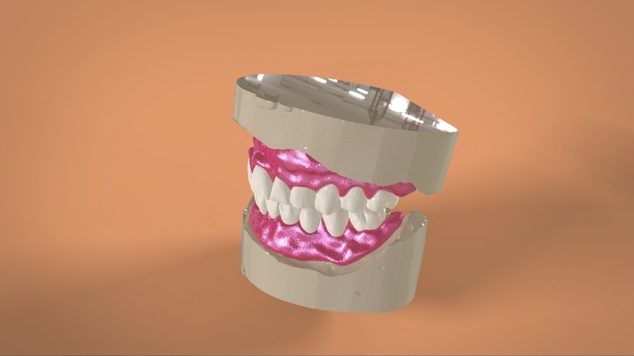 Digital Full Dentures 3D Print 159111 Digital Full Dentures 3D Print 159111