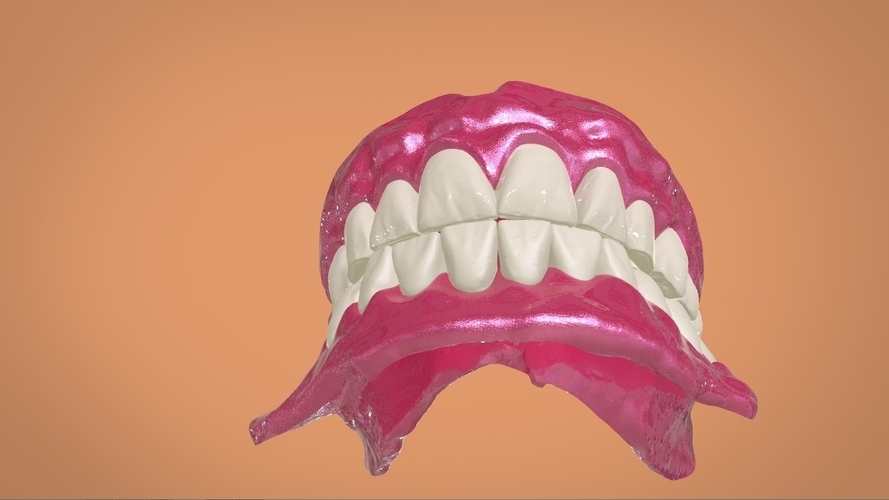 Digital Full Dentures 3D Print 159113 Digital Full Dentures 3D Print 159113
