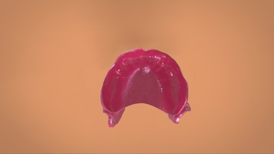 Digital Full Dentures 3D Print 159114 Digital Full Dentures 3D Print 159114