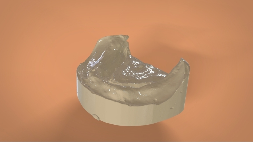 Digital Full Dentures 3D Print 159118 Digital Full Dentures 3D Print 159118
