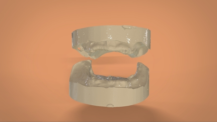 Digital Full Dentures 3D Print 159119 Digital Full Dentures 3D Print 159119