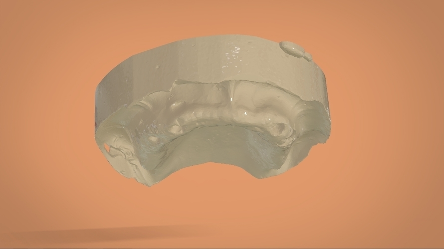 Digital Full Dentures 3D Print 159121 Digital Full Dentures 3D Print 159121