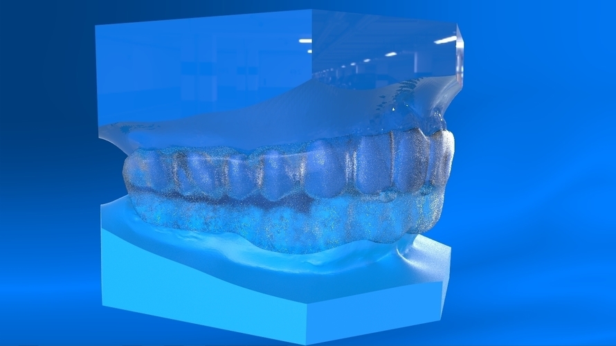Digital Tooth Positioner 3D Print 159620 Digital Tooth Positioner 3D Print 159620