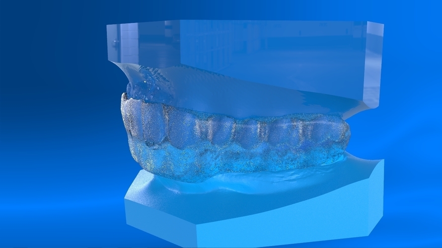 Digital Tooth Positioner 3D Print 159621 Digital Tooth Positioner 3D Print 159621
