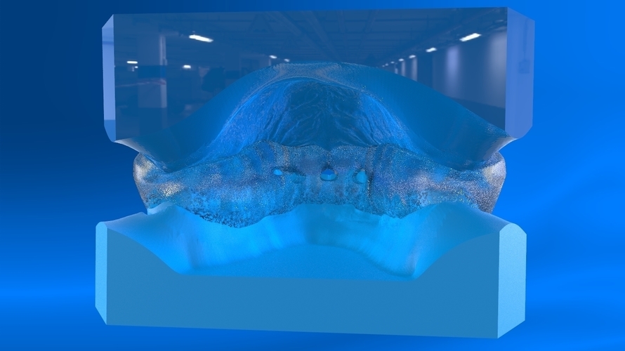 Digital Tooth Positioner 3D Print 159622 Digital Tooth Positioner 3D Print 159622
