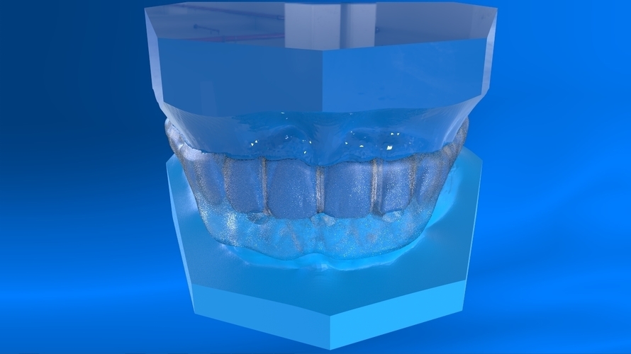 Digital Tooth Positioner 3D Print 159623 Digital Tooth Positioner 3D Print 159623