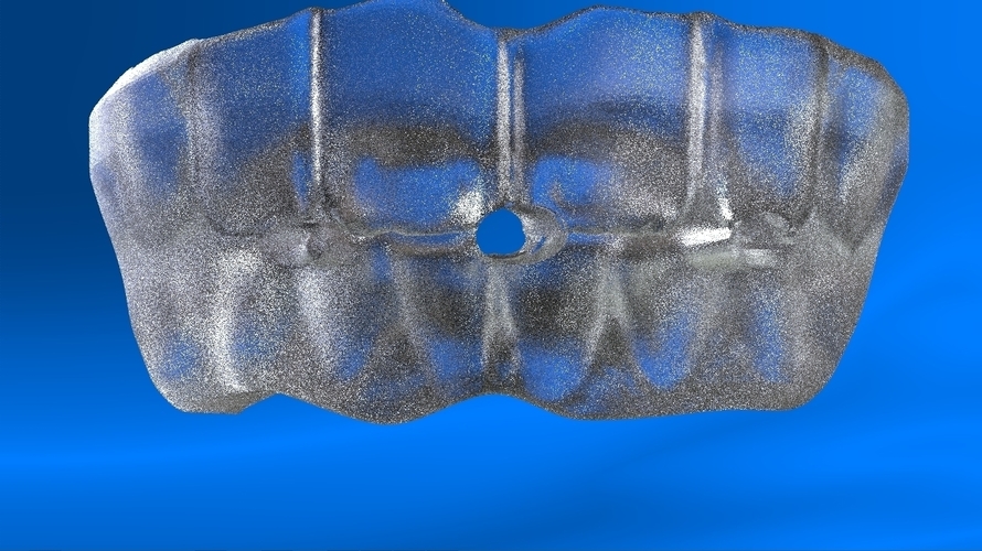 Digital Tooth Positioner 3D Print 159624 Digital Tooth Positioner 3D Print 159624